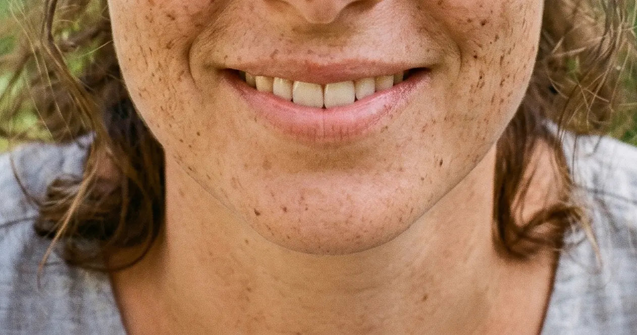 Comment Atténuer Naturellement les Tâches sur le Visage